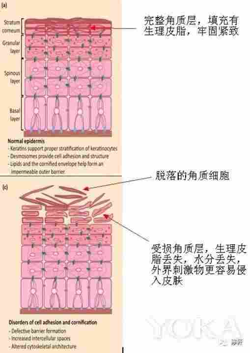 皮肤红血丝怎么办？